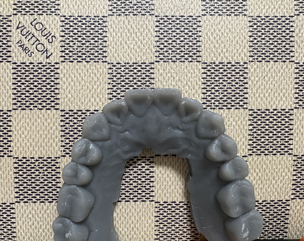 歯科専用３Dプリンター