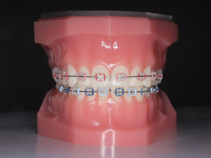 250226_002