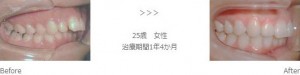 treatment_img002