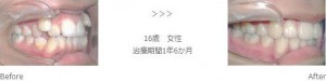 treatment_img005