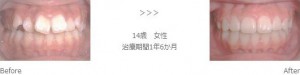 treatment_img006