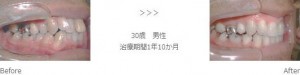 treatment_img007
