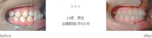 treatment_img009