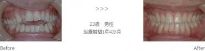 treatment_img010