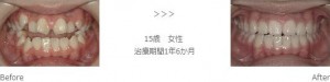 treatment_img011