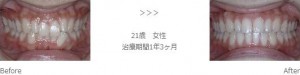 treatment_img012