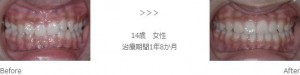 treatment_img013