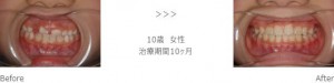 treatment_img014