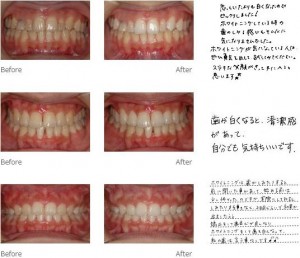 treatment_img015